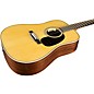 Martin Custom Shop 28 HD Style Adirondack Spruce-East Indian Rosewood Dreadnought Acoustic-Electric Guitar Natural