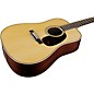 Martin Custom Shop 28 Style Adirondack Spruce-East Indian Rosewood Dreadnought Acoustic Guitar Aging Toner