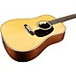 Martin Custom Shop HD 28 Style Adirondack Spruce-East Indian Rosewood Dreadnought Acoustic-Electric Guitar Aging Toner