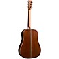 Martin HD-28 Semiquincentennial Dreadnought Acoustic Guitar - Custom Artwork